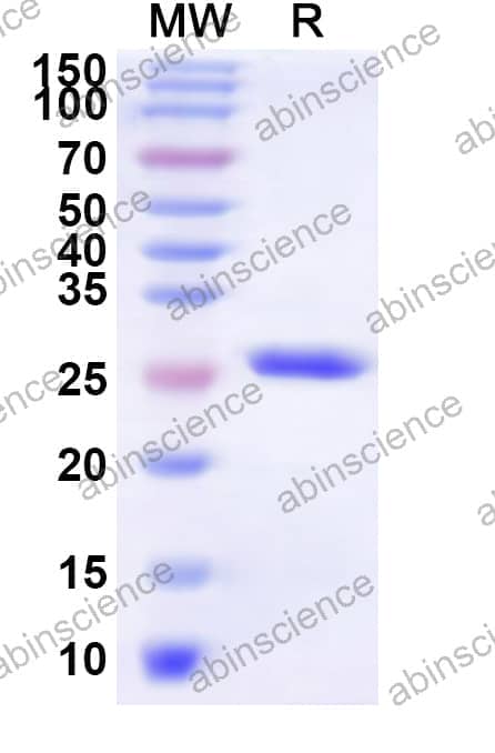 Human GPER1 Recombinant Protein (N-His-KSI)