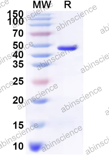 Human MAS1 Recombinant Protein (N-GST & C-His)