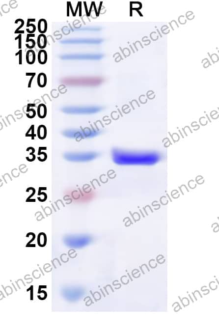 Human P2RY1 Recombinant Protein (N-His-KSI)
