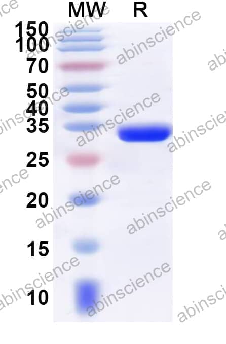 Human UBAP2L Recombinant Protein (N-GST & C-His)