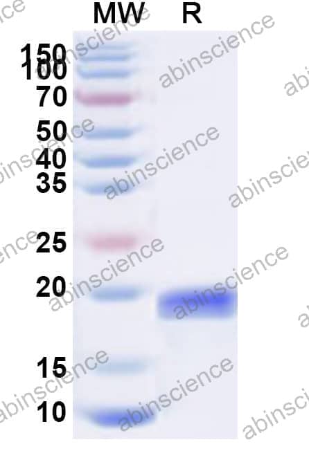 Human LAIR2 Recombinant Protein (N-His)