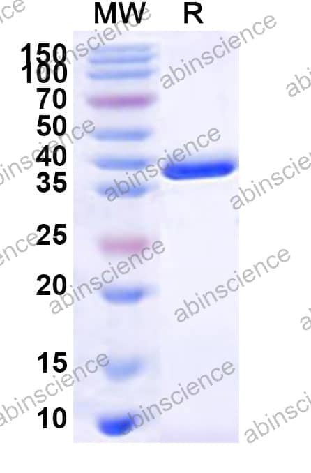 Human ELOVL4 Recombinant Protein (N-GST & C-His)