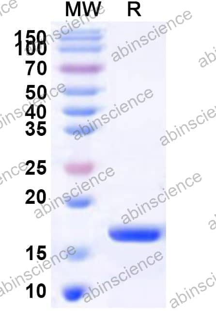 Human NCAPH2 Recombinant Protein (N-His)