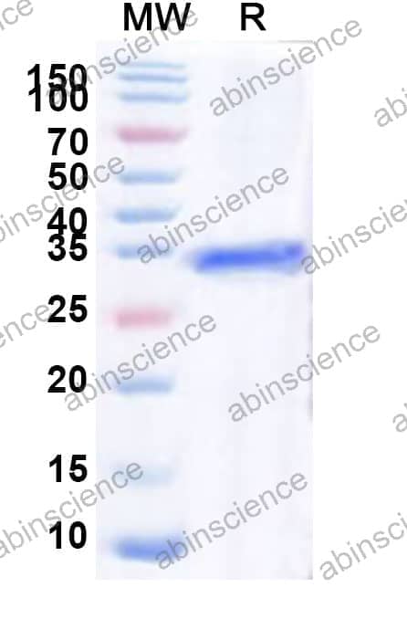 Human HLX Recombinant Protein (N-GST & C-His)