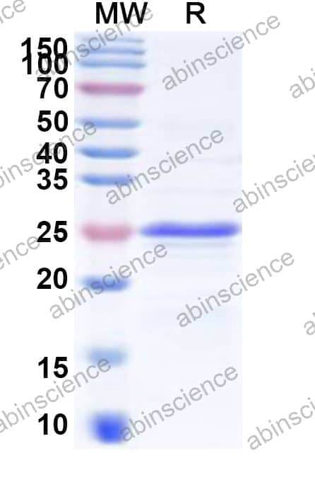 Human CDSN Recombinant Protein (N-His-KSI)