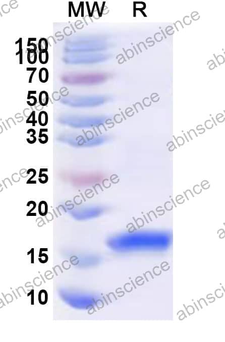 Human MAPRE2 Recombinant Protein (N-His)