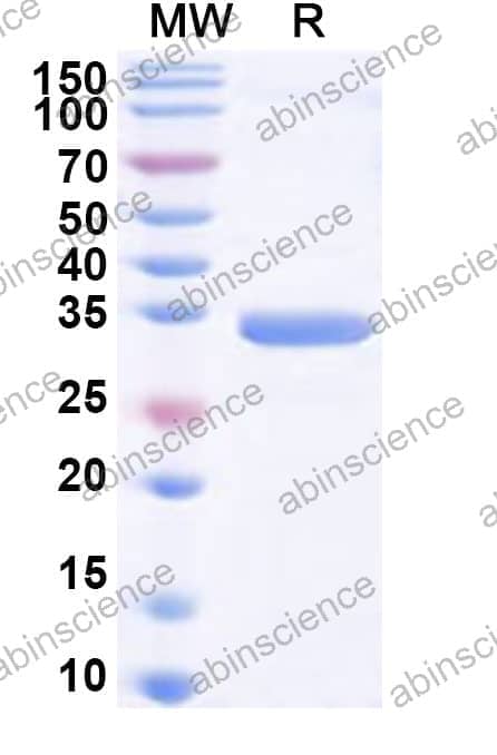 Human SLC35A1 Recombinant Protein (N-GST & C-His)