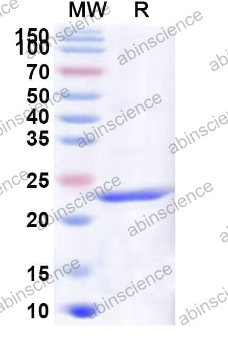 Human SCD5 Recombinant Protein (N-His)
