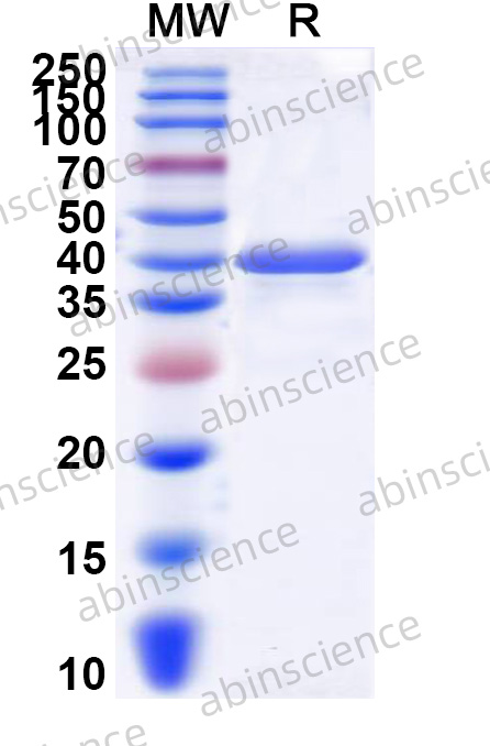 Human PLIN5 Recombinant Protein (N-His)