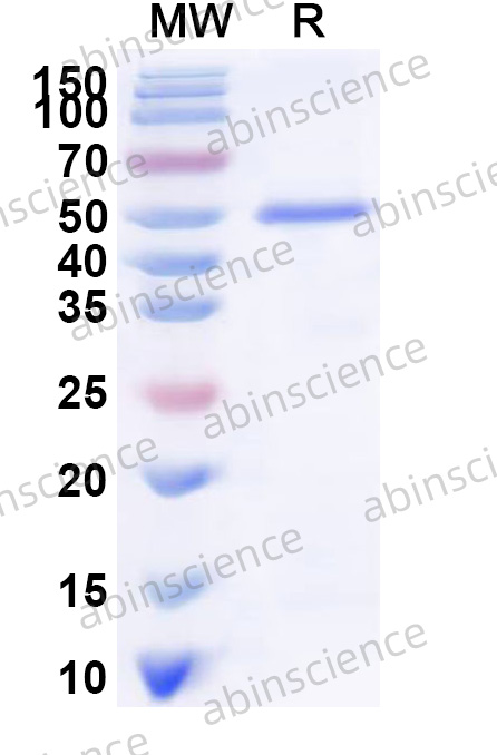Human PRMT2 Recombinant Protein (N-His)
