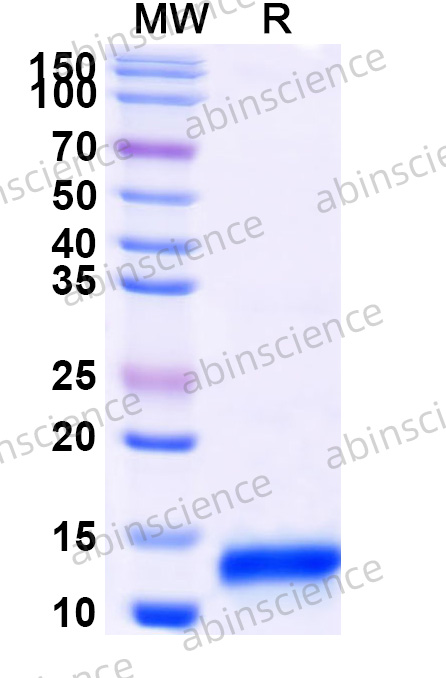 Human KLF13 Recombinant Protein (N-His)