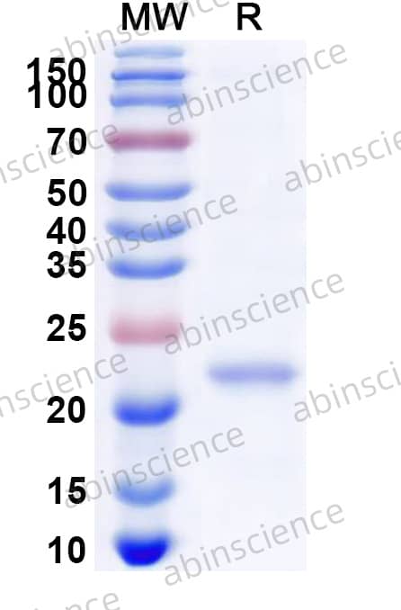 Human/Mouse/Rat ARL8B Recombinant Protein (N-His)
