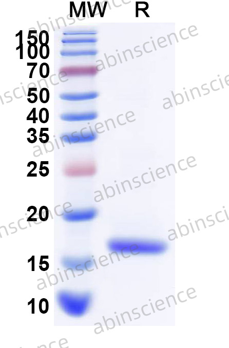 Human NEXN/Nexilin Recombinant Protein (N-His)
