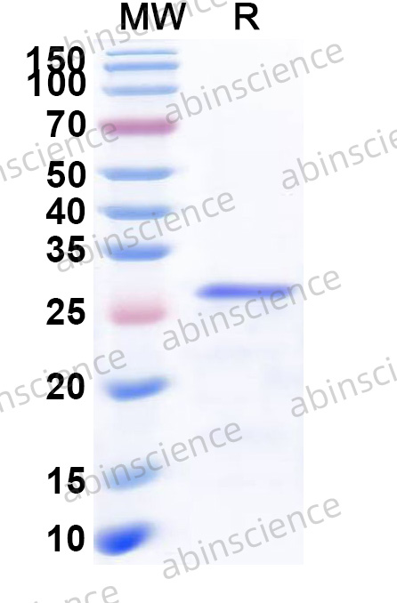 Human KLF10 Recombinant Protein (N-His-SUMO)