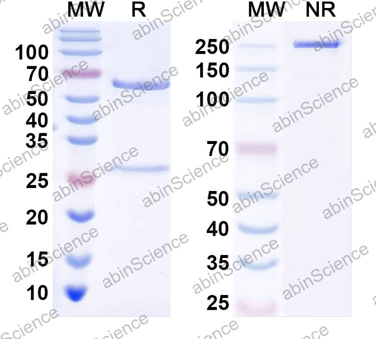 Anti-Human SLC35B1 Recombinant Antibody (SAA2353)