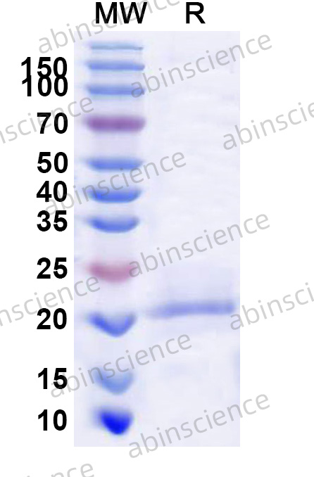Human CDCA8/Borealin Recombinant Protein (N-His)