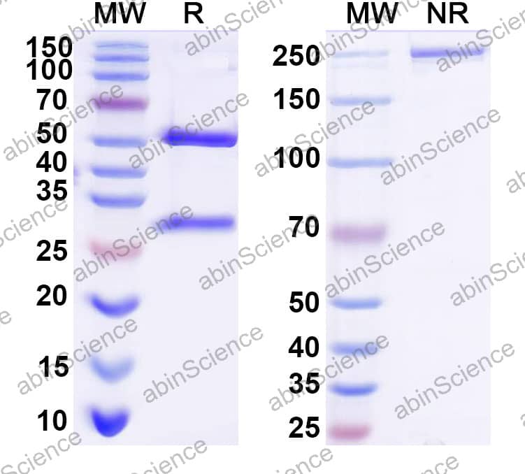 Anti-Human SLC15A4 Recombinant Antibody (SAA2356)
