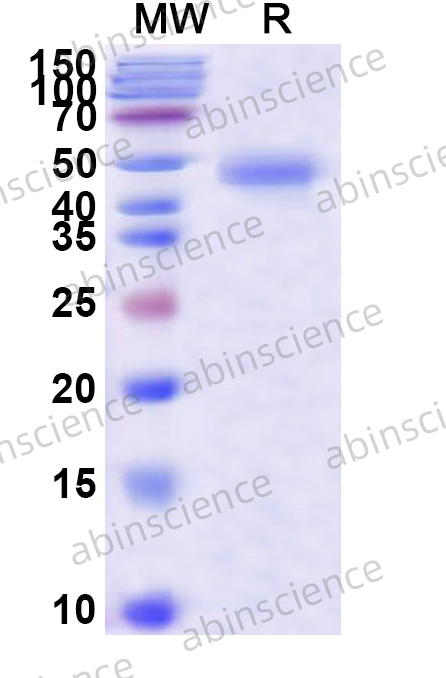 CBLB/RNF56 Recombinant Protein (N-His)