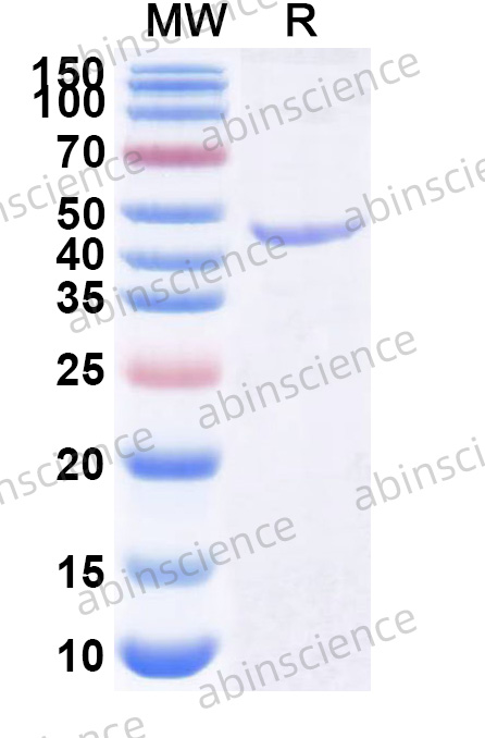 Human AIFM2/FSP1 Recombinant Protein (N-His)