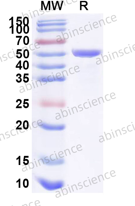 Human FXR2 Recombinant Protein (N-His)