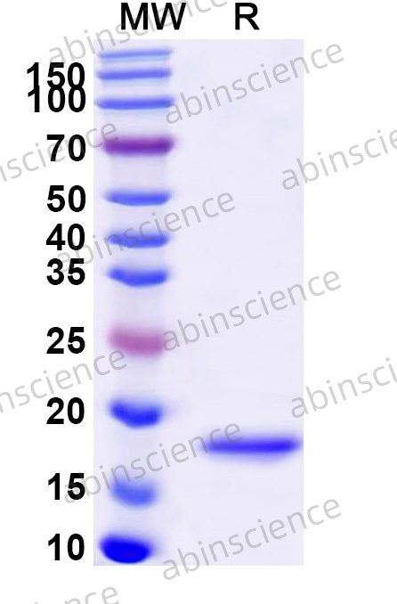 Human RFXAP Recombinant Protein (N-His)