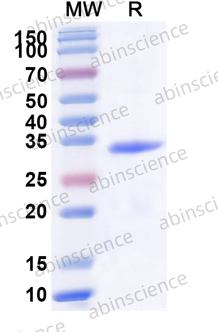 Human PSMA6 Recombinant Protein (N-His)