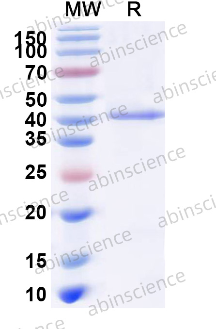 Human VPS35 Recombinant Protein (N-His)