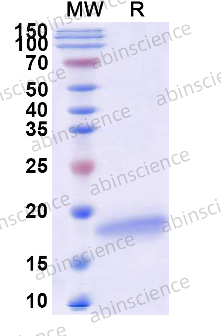 Human TRIM25 Recombinant Protein (N-His)