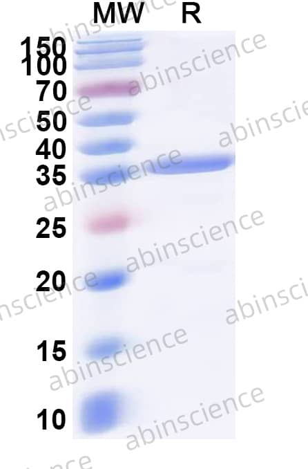 Human CAPN1 Recombinant Protein (N-His)