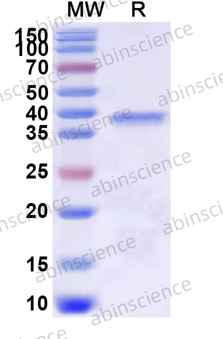 Human B3GNT6 Recombinant Protein (N-His)