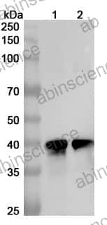 Anti-Human B3GNT6 Polyclonal Antibody