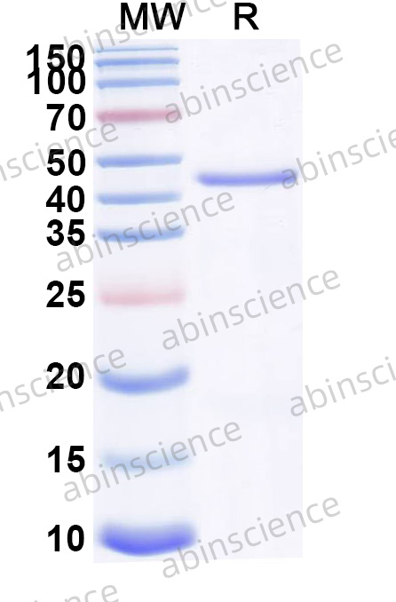 Human EXOC8 Recombinant Protein (N-His)