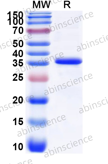 Human CILP2 Recombinant Protein (N-His)