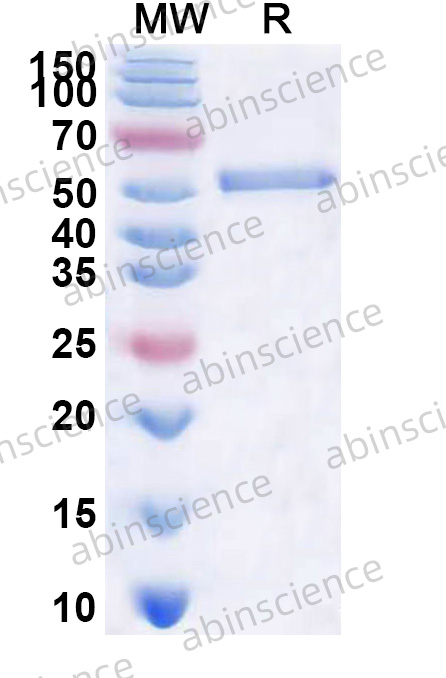 Human HKDC1 Recombinant Protein (N-His)