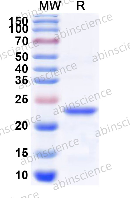 Human TRIM22 Recombinant Protein (N-His)