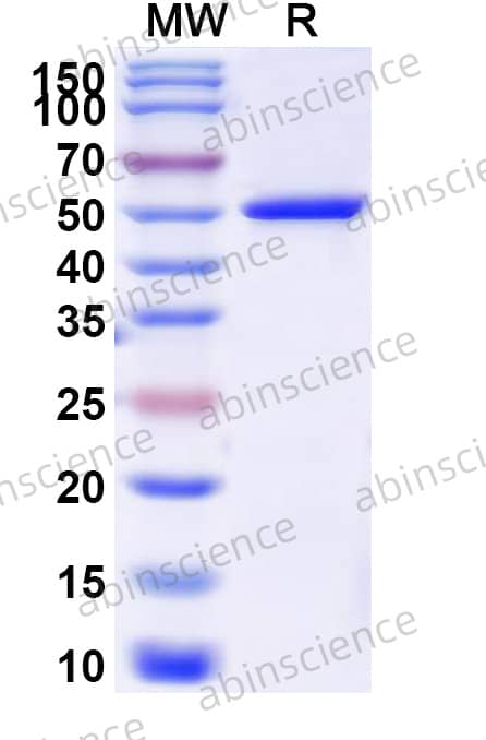 Human ACOT1 Recombinant Protein (N-His)