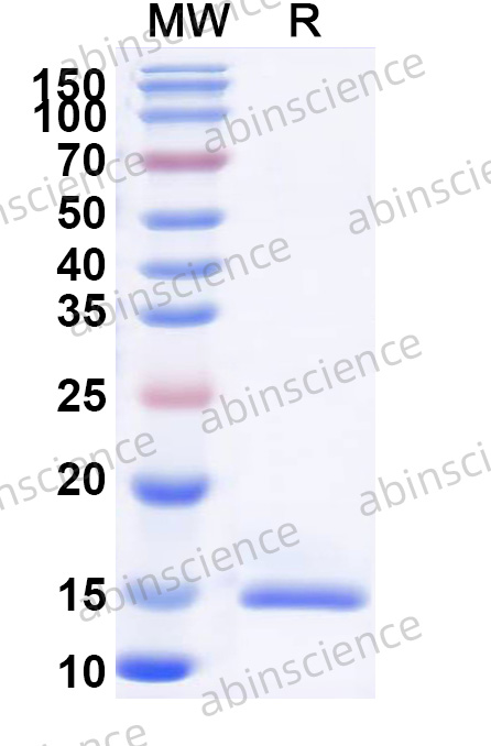 Human IgG1 CH1 Recombinant Protein (N-His)