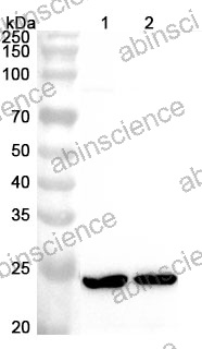 Anti-Human ATP5PB Polyclonal Antibody