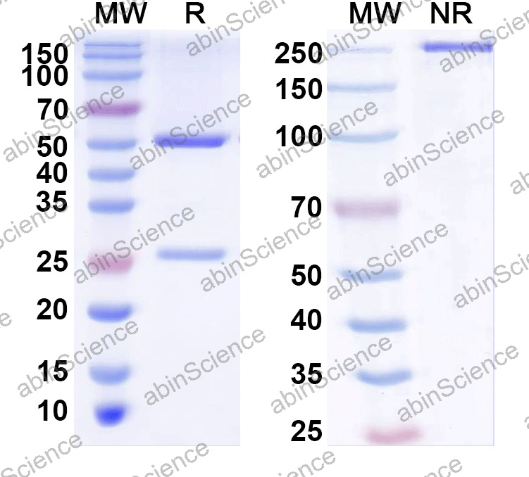 Anti-Human CIITA Monoclonal Antibody (1A619)