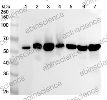 Anti-Human SNTA1 Polyclonal Antibody