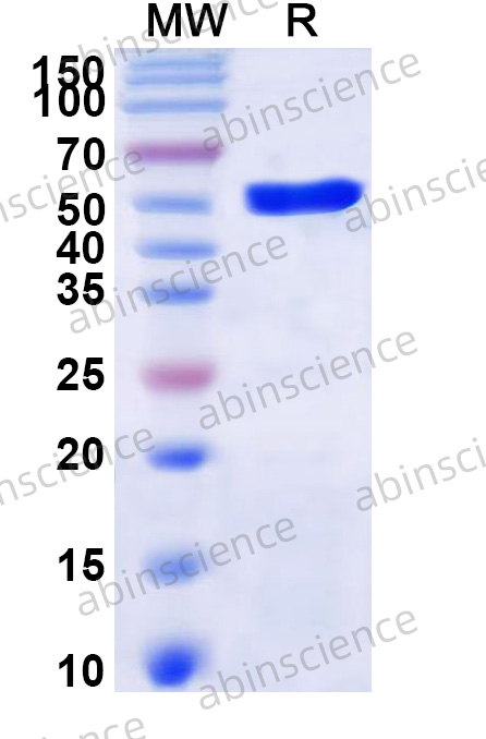 Human PFKFB3 Recombinant Protein (N-His)