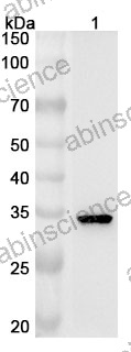 Anti-Human SRM Polyclonal Antibody
