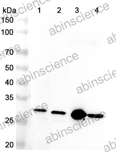 Anti-Human TACO1 Polyclonal Antibody