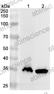 Anti-Human GNB1 Polyclonal Antibody