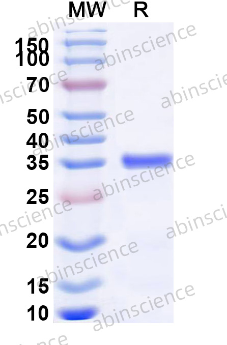 Human ARHGAP24 Recombinant Protein (N-His)