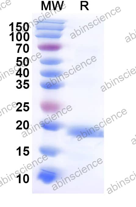 Human FSTL1 Recombinant Protein (N-His)