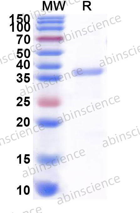 Human KEAP1 Recombinant Protein (C-His)