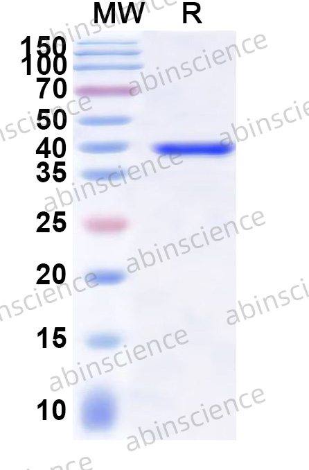 Human EFEMP1/Fibulin-3 Recombinant Protein (N-His)