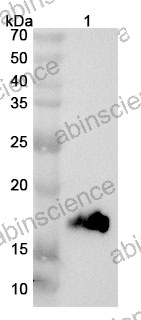 Anti-Human LY6D Polyclonal Antibody
