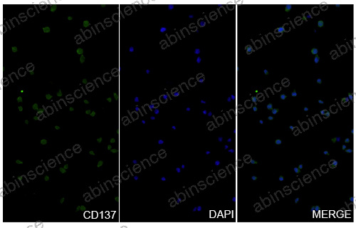 Anti-Human 4-1BB/TNFRSF9/CD137 Recombinant Nanobody (SAA1117)